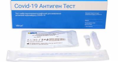 Новости компаний Альтернатива ПЦР-исследованию — новые экспресс-тесты для выявления антигенов коронавируса COVID-19 от украинского производителя - tsn.ua - Украина