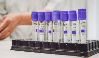 Что из себя представляет вакцина от COVID-19 - nashgorod.ru - Россия