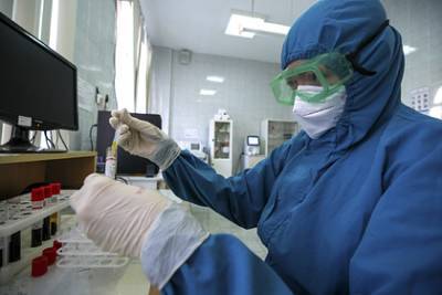 Сергей Нетесов - Вирусолог назвал самое необычное свойство коронавируса - lenta.ru - Россия - Новосибирск