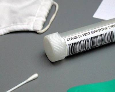 В США позволили использовать первый тест на коронавирус в домашних условиях - argumenti.ru - Сша