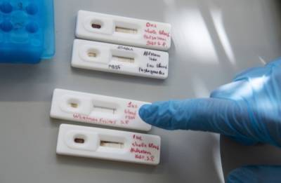 Пять томских медиков получили положительный тест на коронавирус после вакцинации - interfax-russia.ru