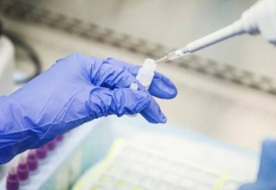 В США появятся "домашние" тесты на коронавирус - facenews.ua - Украина - Сша