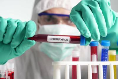 В Ленобласти выявили 202 новых зараженных коронавирусом 21 ноября - ivbg.ru - Россия - Санкт-Петербург - Ленобласть обл.