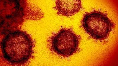 Ученые спрогнозировали вспышки кори из-за пандемии коронавируса - iz.ru - Австралия - Израиль - Мельбурн