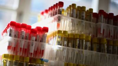 ВОЗ заявила о более 604 тысячах случаев коронавируса в мире за сутки - russian.rt.com