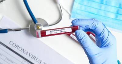 Число заболевших коронавирусом в Украине падает синхронно с сокращением объемов тестирования - focus.ua - Украина