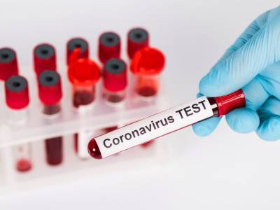Массовое тестирование может помочь "убить" COVID-19 за полтора месяца – исследование - gordonua.com - штат Колорадо