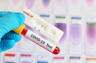 В Украине обнаружили более 661 тыс. случаев коронавируса COVID-19, за последние сутки - 13 882 - zik.ua - Украина