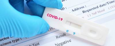 Во Владимирской области обнаружены еще 127 заразившихся COVID-19 - runews24.ru - Владимирская обл.