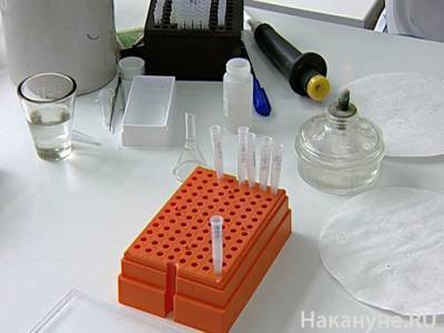 Российская компания разработала тест на коронавирус по слюне - nakanune.ru