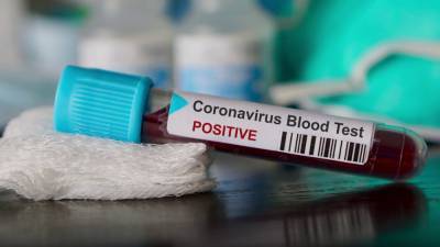 На Сахалине официально зарегистрировали седьмую смерть от коронавируса - sakhalin.info