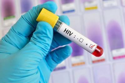 Роспотребнадзор оценил риски заражения ВИЧ-инфицированных COVID-19 - aif.ru - Россия