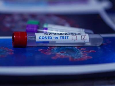 Днепропетровская область меньше других регионов охвачена тестированиями на коронавирус – данные Минздрава за неделю - gordonua.com - Украина - Днепропетровская обл.