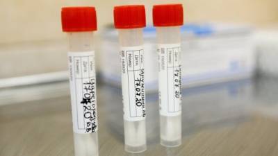 Ученые обнаружили 12 тыс. мутаций у коронавируса SARS-CoV-2 - inforeactor.ru