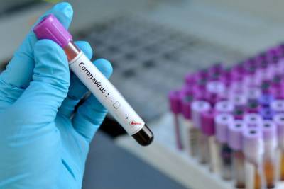 В Ленобласти выявили 210 новых зараженных коронавирусом 30 ноября - ivbg.ru - Россия - Ленобласть обл.