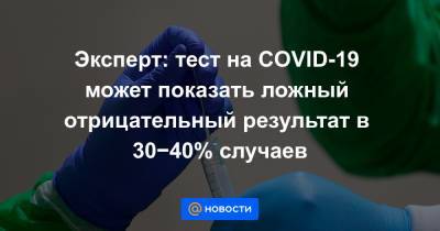 Эксперт: тест на COVID-19 может показать ложный отрицательный результат в 30−40% случаев - news.mail.ru - Россия