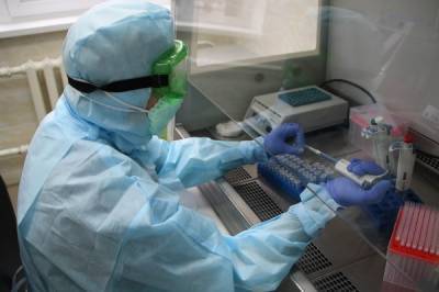 В лабораториях назвали причины ложноотрицательных тестов на COVID-19 - nakanune.ru