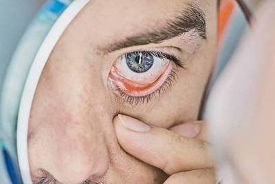 Коронавирус обходит роговицу - versia.ru - Вашингтон