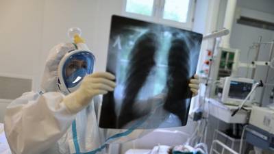 Александр Карабиненко - Пульмонолог рассказал о восстановлении лёгких после COVID-19 - russian.rt.com