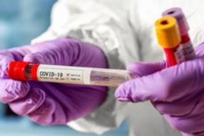 Инфекционист объяснил, как массовое тестирование на COVID-19 может сдержать эпидемию и почему локдаун не поможет - newsone.ua - Украина