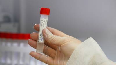 Более 81 млн тестов на коронавирус проведено в России - russian.rt.com - Россия