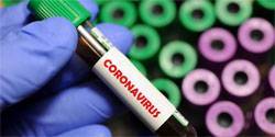 Еще 170 орловцев заразились коронавирусом - vechor.ru - Украина