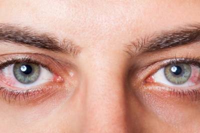 Воспаленные глаза являются еще одним симптомом COVID-19, - ученые - zik.ua