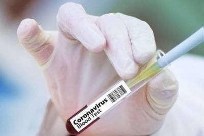 Денис Шмыгаль - Украинский премьер оценил вероятность использования страной российской вакцины от COVID-19 - versia.ru - Украина - Киев