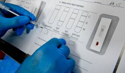 Во Франции забраковали экспресс-тест на коронавирус: его продают и в Украине - 24tv.ua - Франция - Украина - Англия