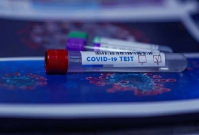 Более 35 тысяч человек в Петербурге сдали тест на коронавирус за минувшие сутки - online47.ru - Санкт-Петербург