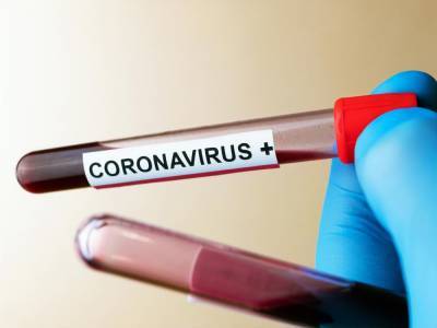 В Украине выявили 2 тыс. случаев повторного инфицирования коронавирусом - gordonua.com - Украина