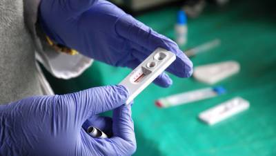 Российская вакцина от ВИЧ показала положительный результат - gazeta.ru
