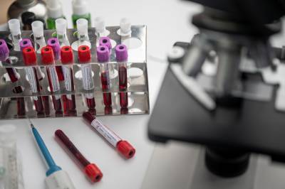 Российская вакцина от ВИЧ выработала антитела к вирусу - neva.today