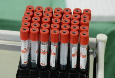Более 2,8 тыс. новых случаев коронавируса зарегистрировано в Поволжье - interfax-russia.ru