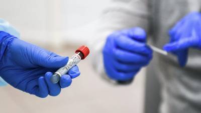 В Подмосковье провели более 1 млн тестов на антитела к коронавирусу - russian.rt.com