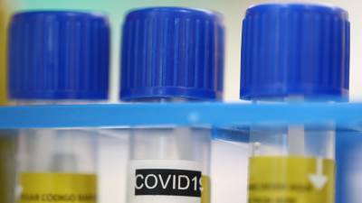 В Молдавии за сутки выявили 1717 новых случаев коронавируса - russian.rt.com