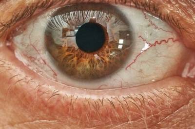 Ученые рассказали о случаях потери зрения после коронавируса - aif.ru