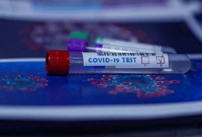 Более 28 тысяч человек в Петербурге сдали тест на коронавирус за минувшие сутки - online47.ru - Санкт-Петербург