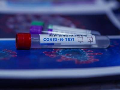 Максим Степанов - Степанов заявил, что в Украине намерены "существенно" увеличить количество тестирований на коронавирус - gordonua.com - Украина
