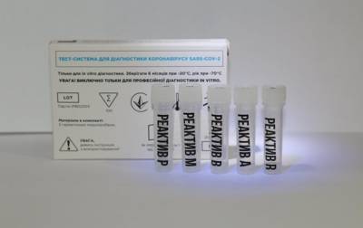 В Украине разработан тест для одновременного определения COVID-19 и гриппа - korrespondent.net - Украина