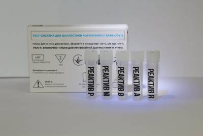 В Украине создали новый ПЦР-тест: Находит COVID и грипп одновременно - news.bigmir.net - Украина