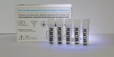 Три в одном: украинские ученые разработали тест для выявления COVID-19 и двух штаммов гриппа - nv.ua - Украина