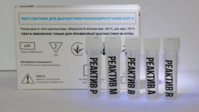 Одновременно определяет COVID-19 и грипп: Украинские ученые создали новый ПЦР-тест - ru.espreso.tv