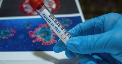 ПЦР тест для определения гриппа и COVID-19: разработка украинских учёных - skuke.net