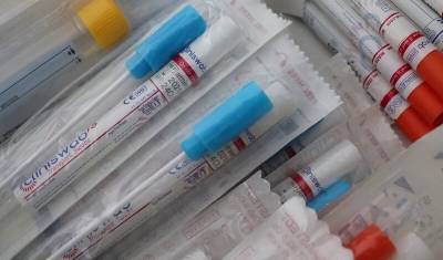 Российскую вакцину от ковид начали производить в Казахстане - mkset.ru - Россия - Казахстан