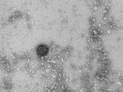 Российские ученые получили из Великобритании образцы нового штамма коронавируса - nakanune.ru - Англия