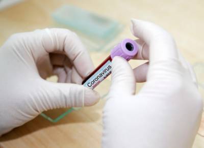 Где сдать тест на коронавирус в Москве? - newsland.com - Москва
