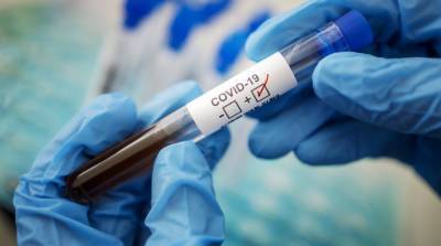 Новый штамм коронавируса: в Швейцарии зафиксировали первые случаи заражения - ru.slovoidilo.ua - Украина - Англия - Швейцария