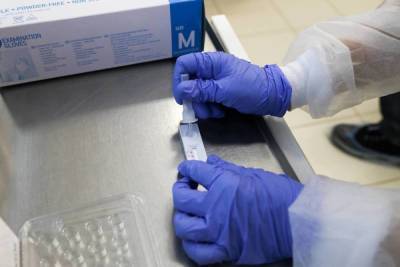 Медик назвал самый быстрый тест на коронавирус - volg.mk.ru