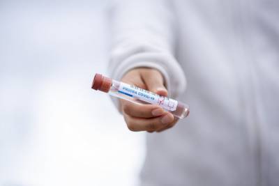 Второй вакциной от коронавируса уже прививают жителей в Ростовской области - privet-rostov.ru - Ростовская обл.